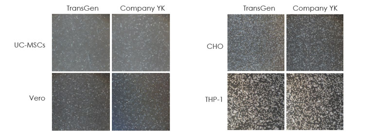 使用TransGen 凍存液和Company YK 無(wú)DMSO 無(wú)蛋白凍存液在-80℃凍存1 個(gè)月的多種細胞復蘇24 小時(shí)后細胞貼壁情況的比較