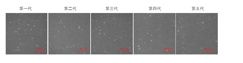 間充質(zhì)干細胞培養圖 間充質(zhì)干細胞培養圖